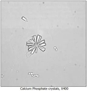 Cristaux de phosphate de calcium