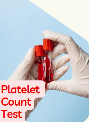 platelet count