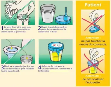 ECBU | Examen cytobactériologique des urines