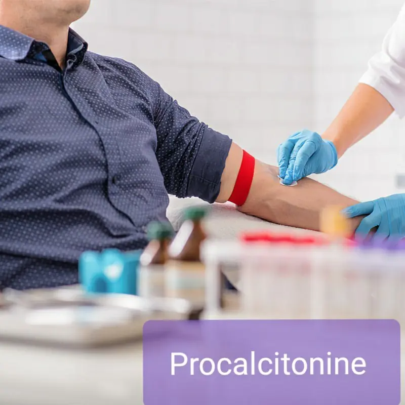 procalcitonine pct