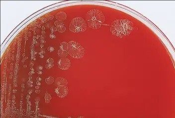 pseudomonas-stutzeri