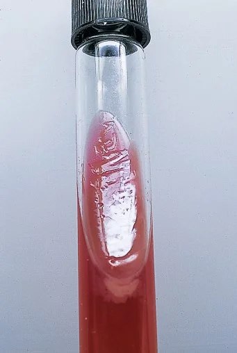 pseudomonas-tsi