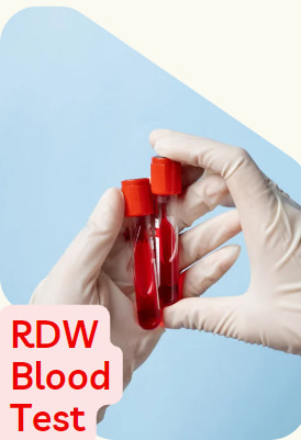 rdw blood Test