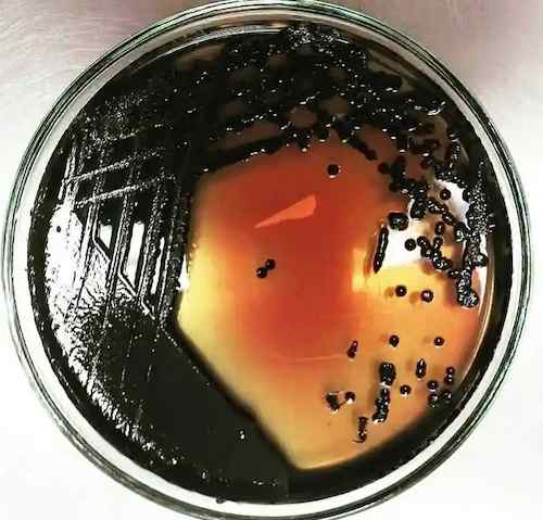 Gélose Salmonella Shigella (SS)