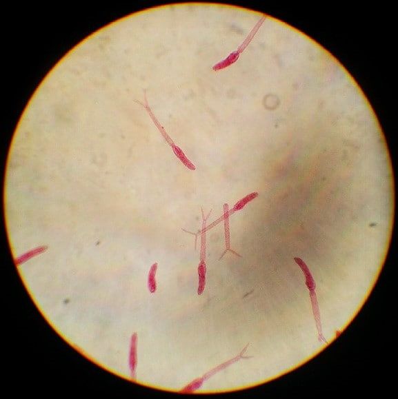     Schistosoma  furcocercaire  