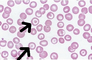 Codocytes