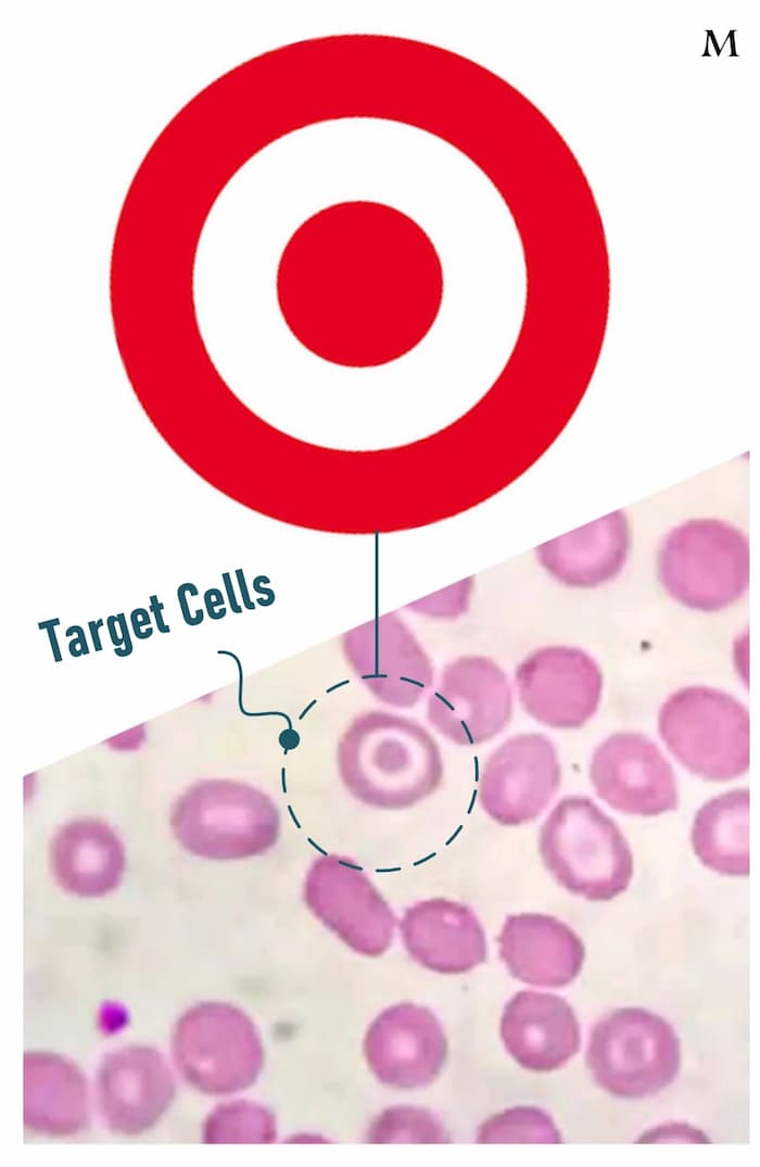 Target cells
