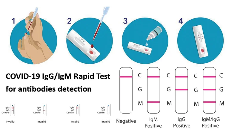 Covid-19: Test Rapide IgG/IgM 