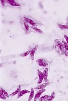 Toxoplasma gondii trophozoite