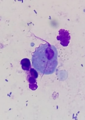 trichomonas-vaginalis