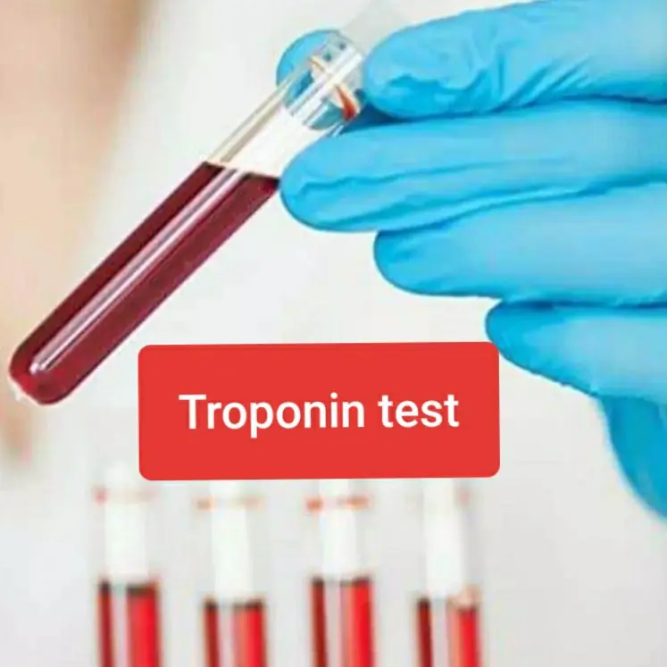 troponin test
