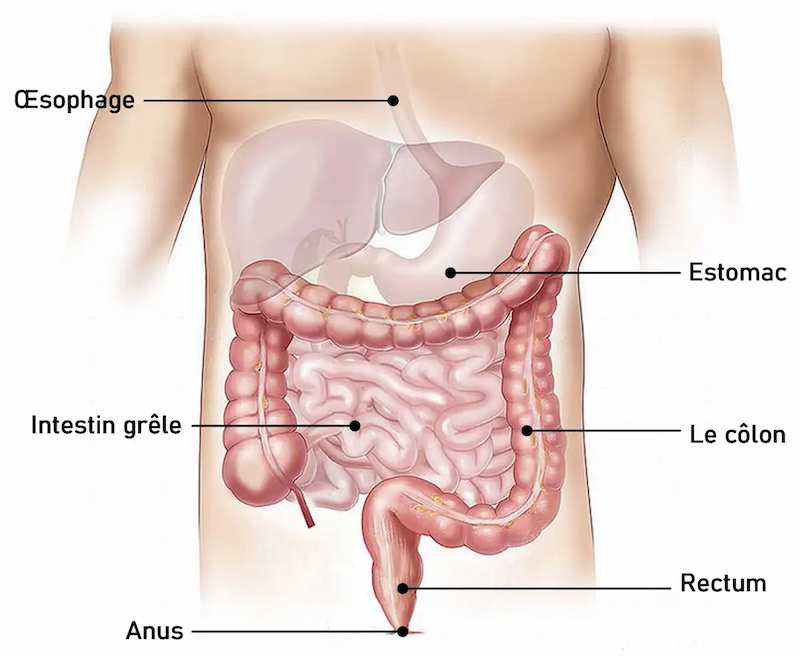 cirrhose