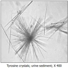 Cristaux de Tyrosine