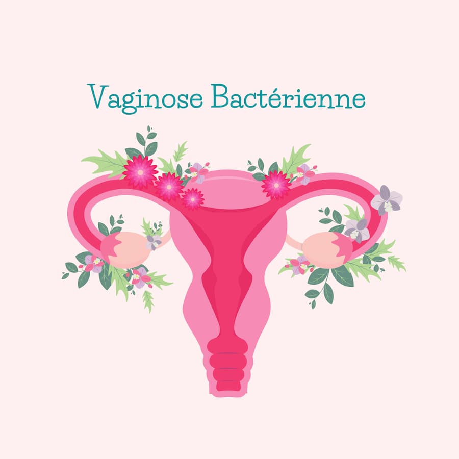 Vaginose bactérienne