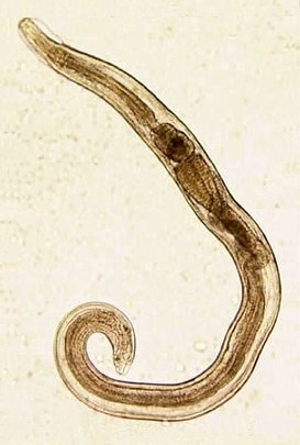 Enterobius vermicularis