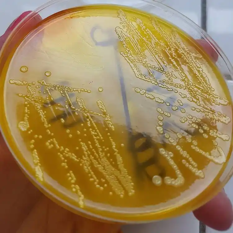 E.coli sur gélose XLD 